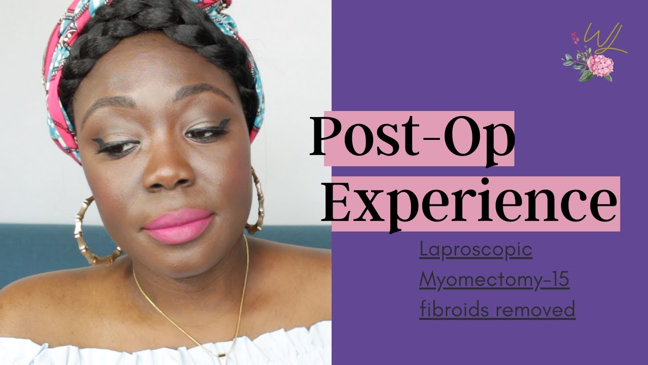 15 Fibroids REMOVED. Laproscopic Myomectomy: Post Ops Experience