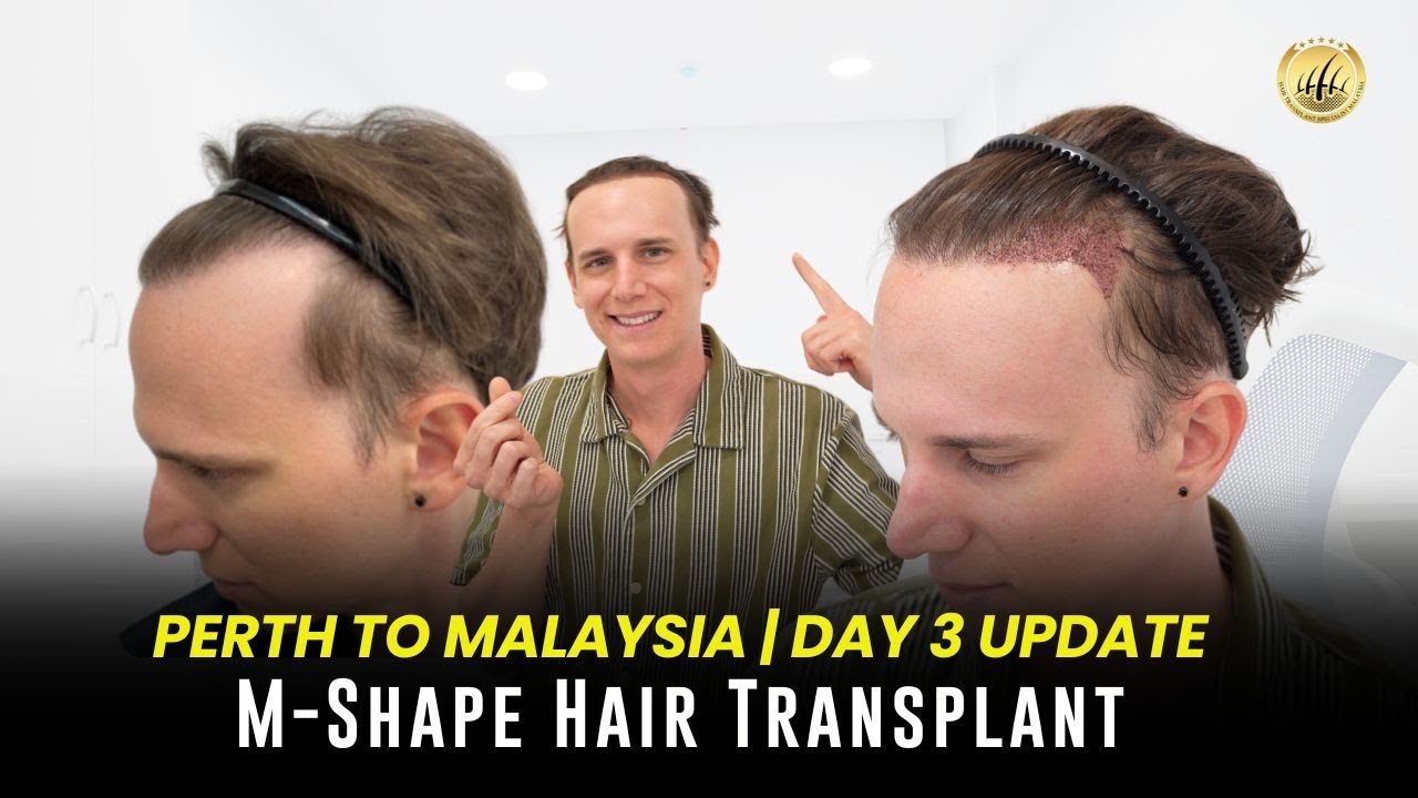 Perth to Malaysia: Day 3 Update of M-Shape Hair Transplant at GLOJAS Clinic! ✈️💇‍♂️