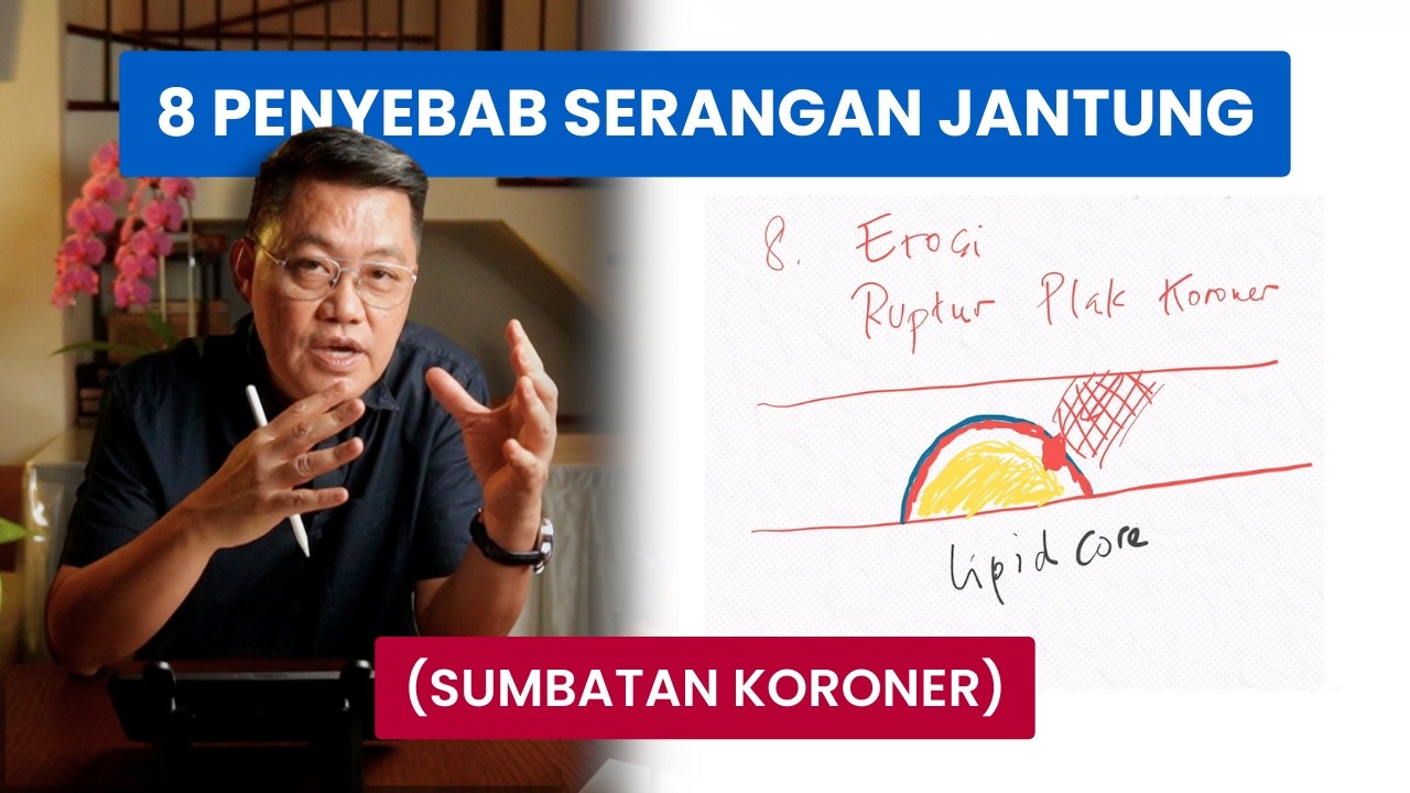 8 Penyebab Serangan Jantung (Sumbatan Koroner)