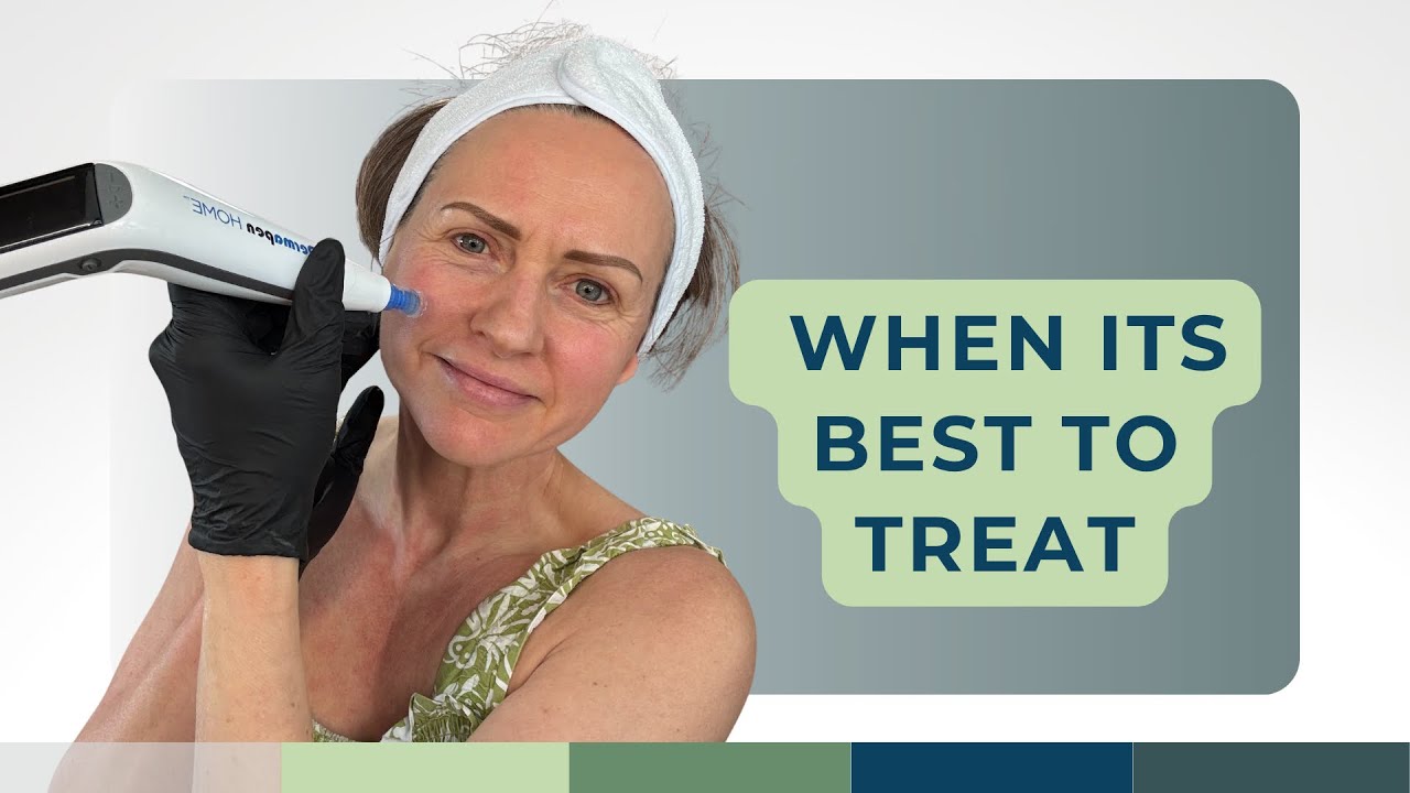 Maximize Your Microneedling Success With Perfect Timing