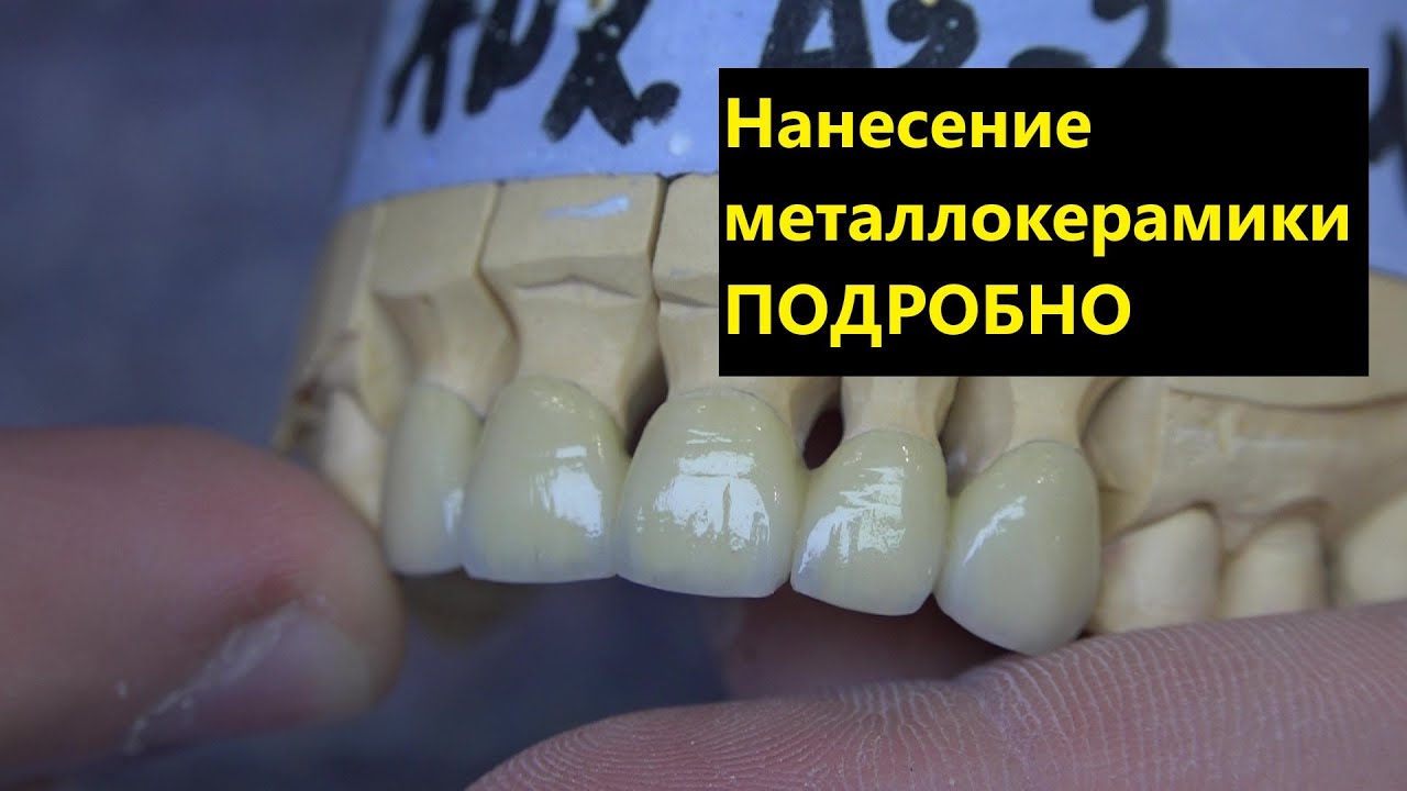 Наненсение керамики INLINE. металлокерамика программы обжига керамики. Как нанести керамический зуб?