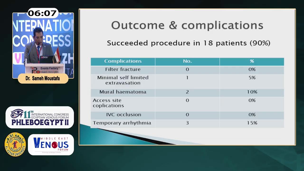 International Union of Angiology Consensus Document on Vascular Compression Syndromes