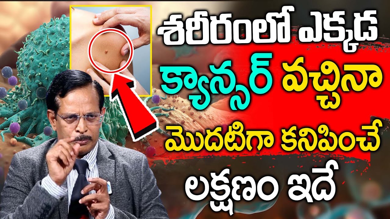 ఒంట్లో కాన్సర్ కణాలు ఉంటె కనిపించే సూచనలు | Dr.D Ram Mohan Reddy About Cancer symptoms | iD Health