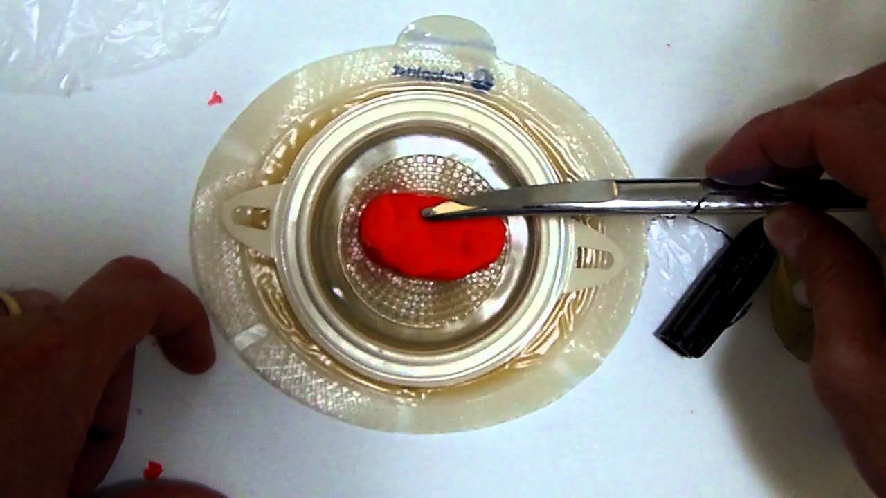 Como colocar bolsa para Colostomia