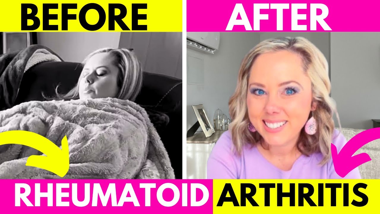 How RA Puts You in a Negative State (And How to Break Free) #rheumatoidarthritis #autoimmunedisease