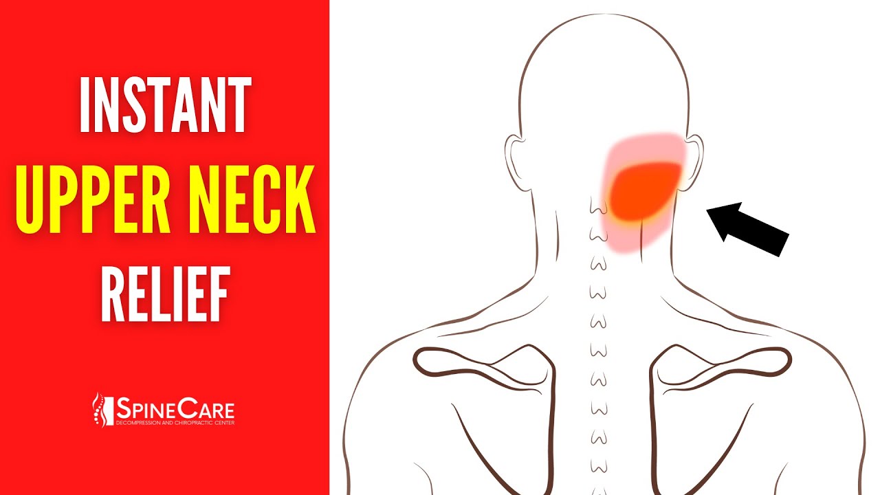 How to Fix Upper Neck Pain FOR GOOD