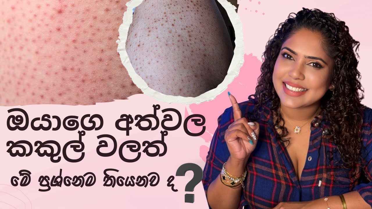 Strawberry skin නැති කරගන්නෙ කොහොමද? | How to get rid of strawberry skin