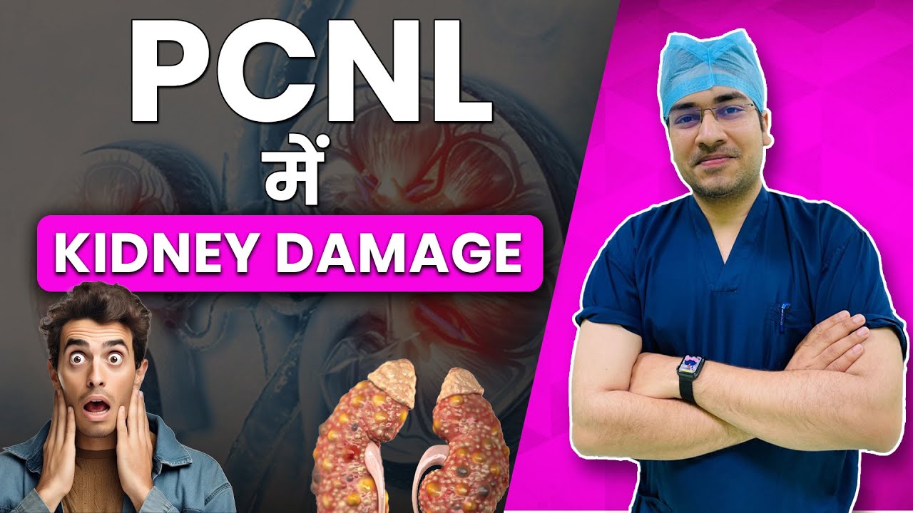 क्या Kidney stones निकालने के लिए PCNL सही विधि है? | Is PCNL Right for Kidney Stone Removal? #pcnl