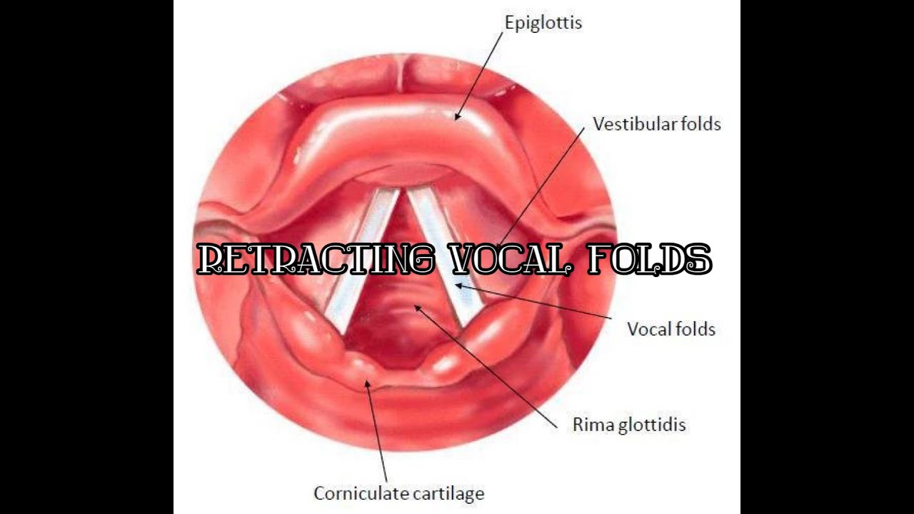 🎭 How to Retract Your False Vocal Folds – Unlock Open Throat Singing!
