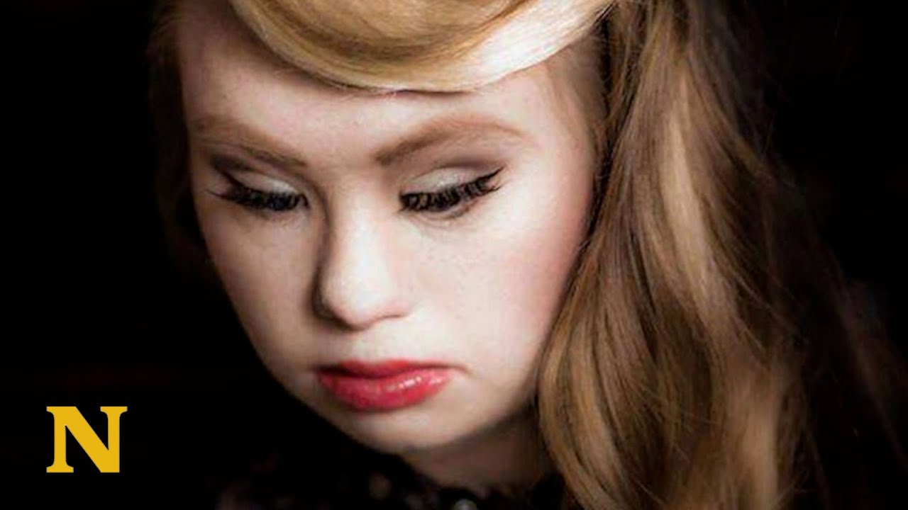 Girl With Down Syndrome Is Crushing Stereotypes All Around The World