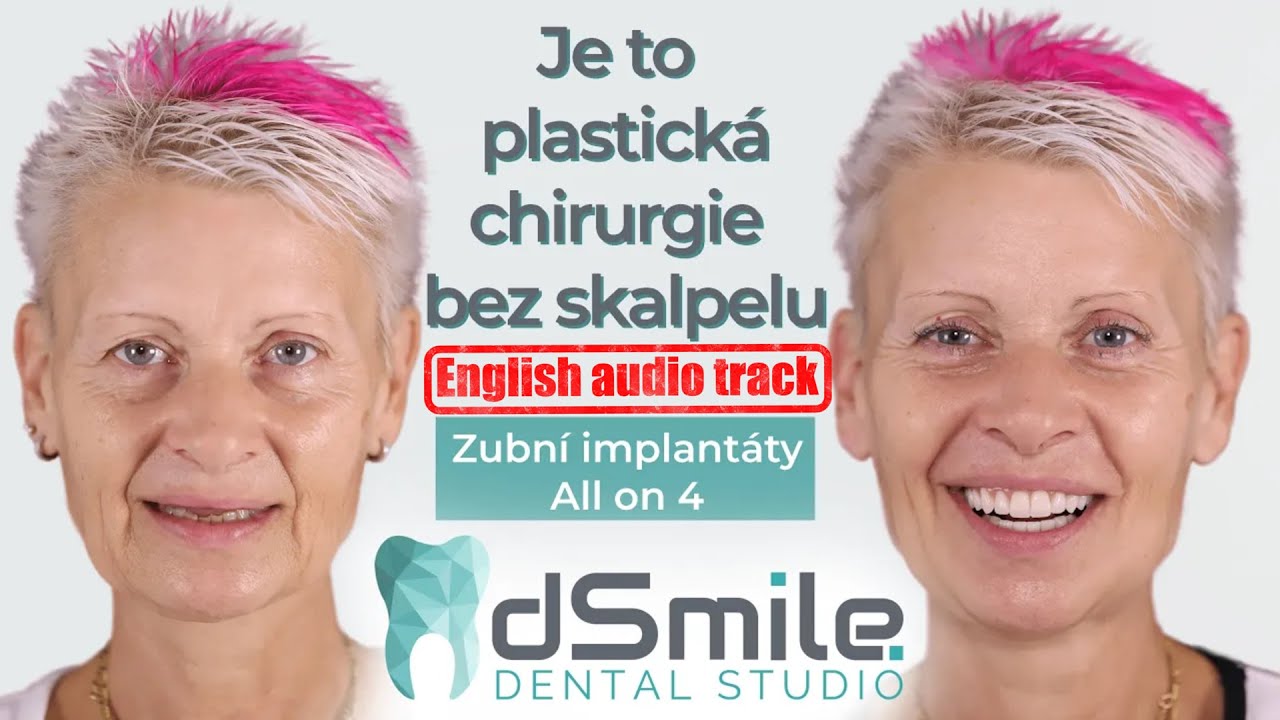 Plastická a estetická chirurgie se začíná v zubní ordinaci