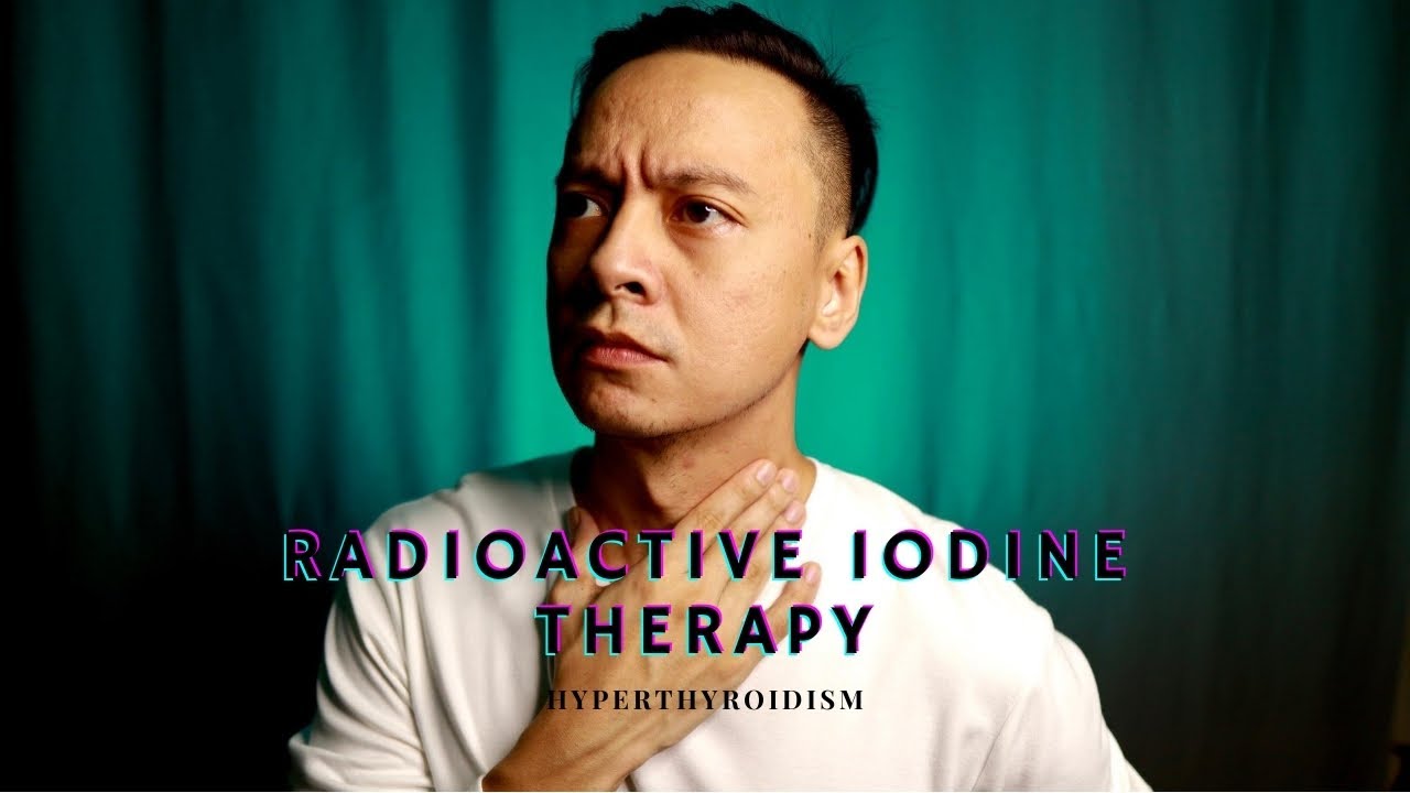 RadioActive Iodine Therapy for  hyperthyroid