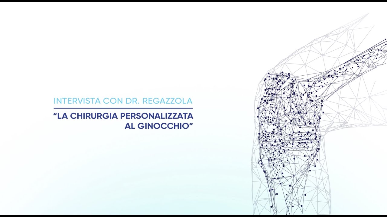 Chirurgia personalizzata al ginocchio