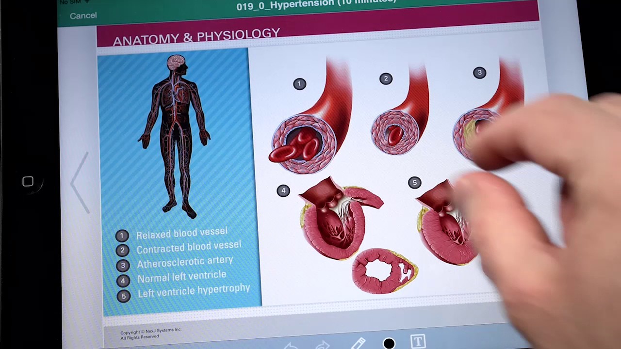 Improve Understanding and Adherence with Patient Education