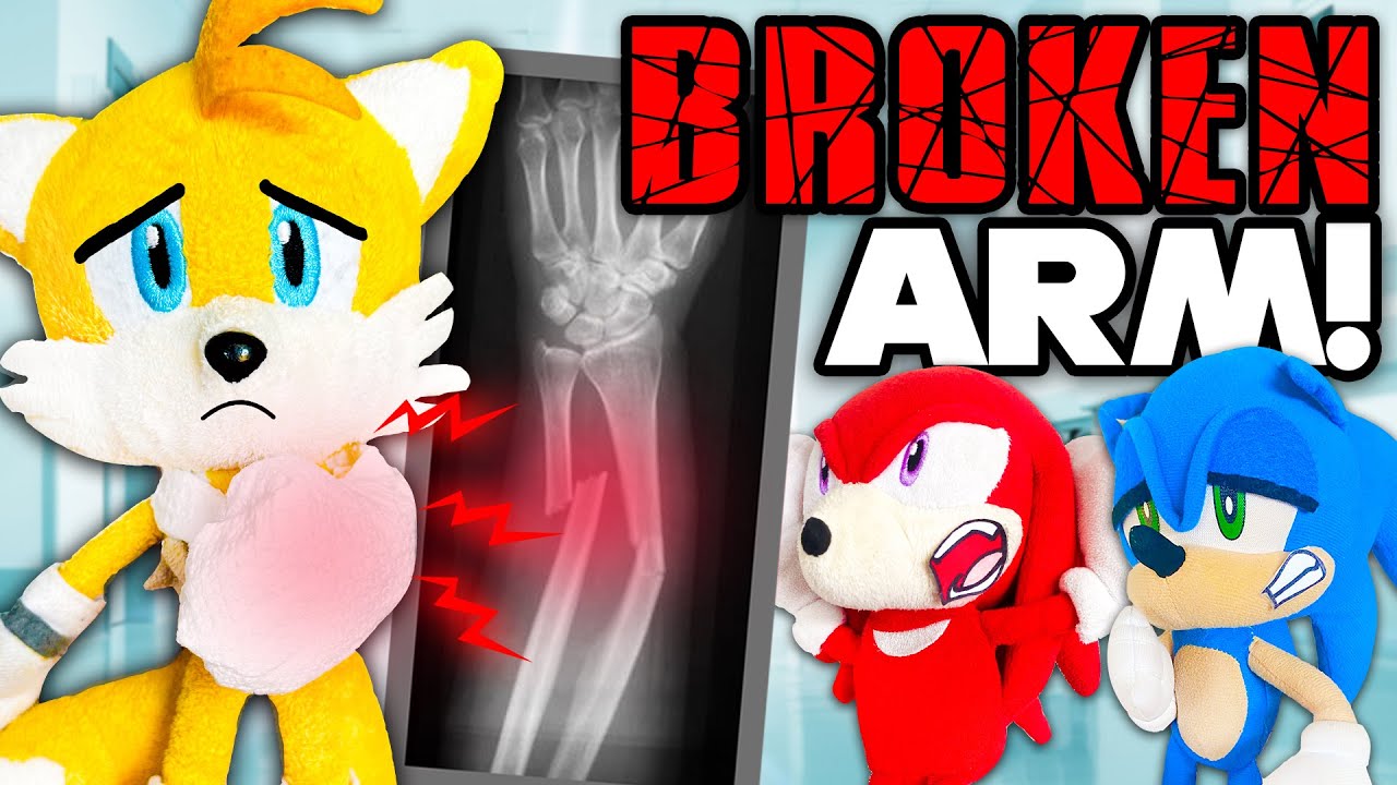 Tails' Broken Arm! - Sonic and Friends