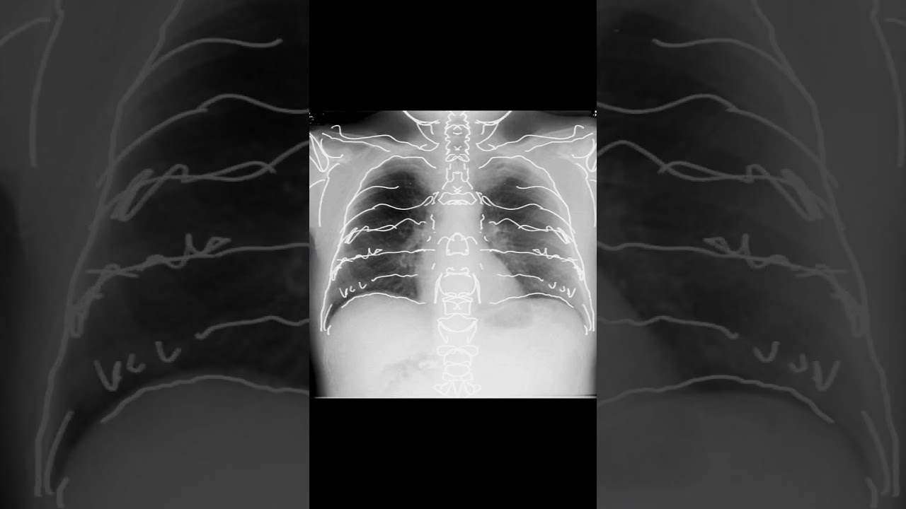 Radiograf&iacute;a #radiografia #rayosx #radiography #art #arte #radiograph