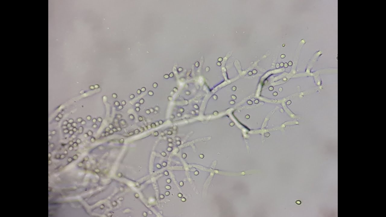 Contaminación por Trichoderma o Penicillium, Tratando de identificar