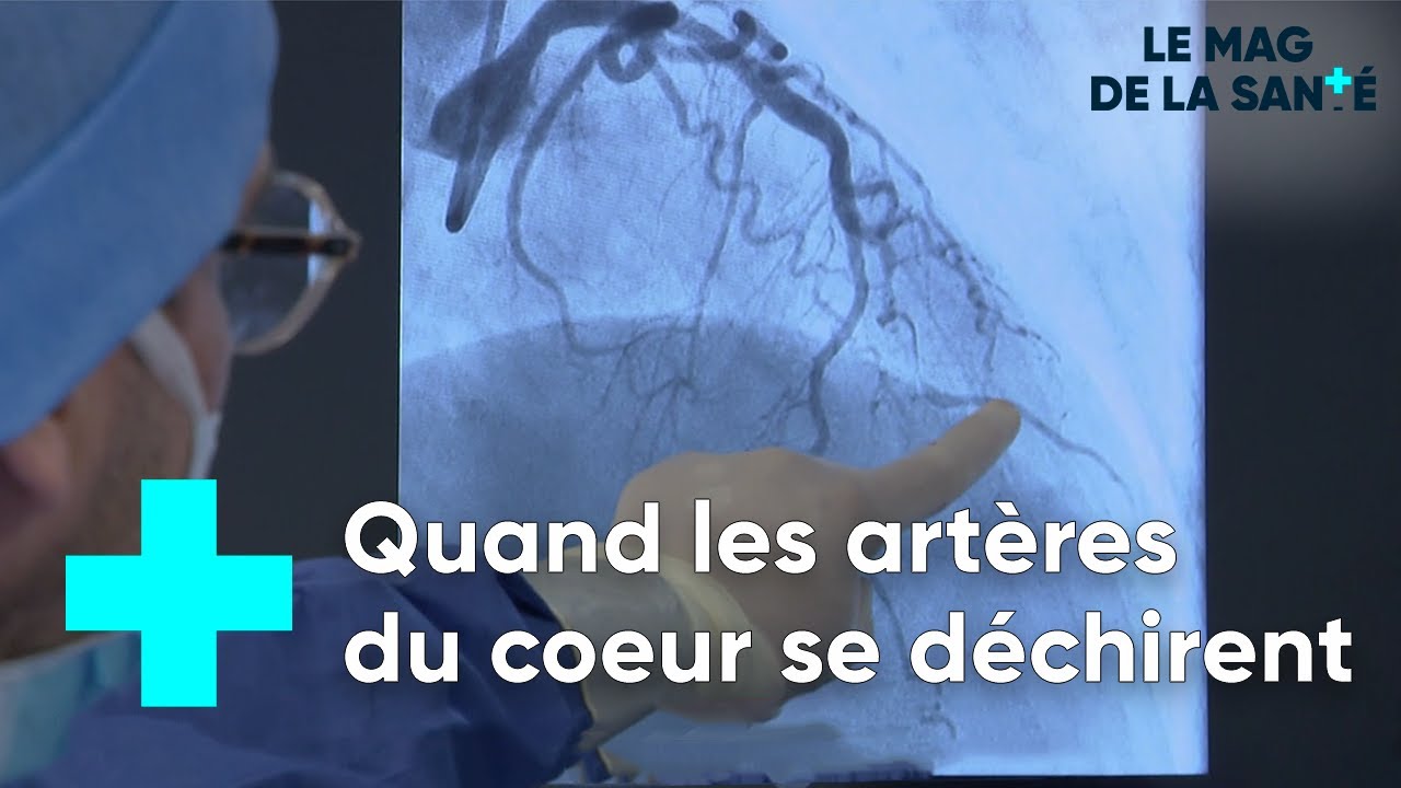 La dissection coronaire, un accident cardiaque méconnu - Le Magazine de la Santé