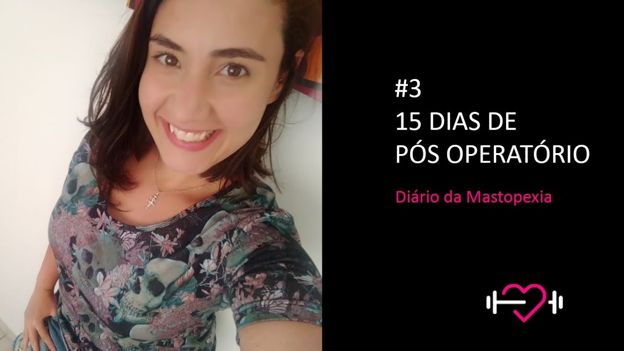 #3 15 dias de pós operatório | DIÁRIO DA MASTOPEXIA
