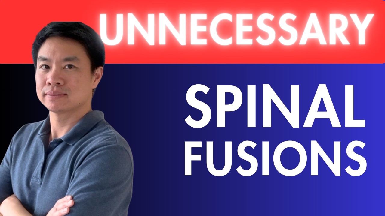 Laminectomy With or Without Fusion? 3 Things You MUST Know