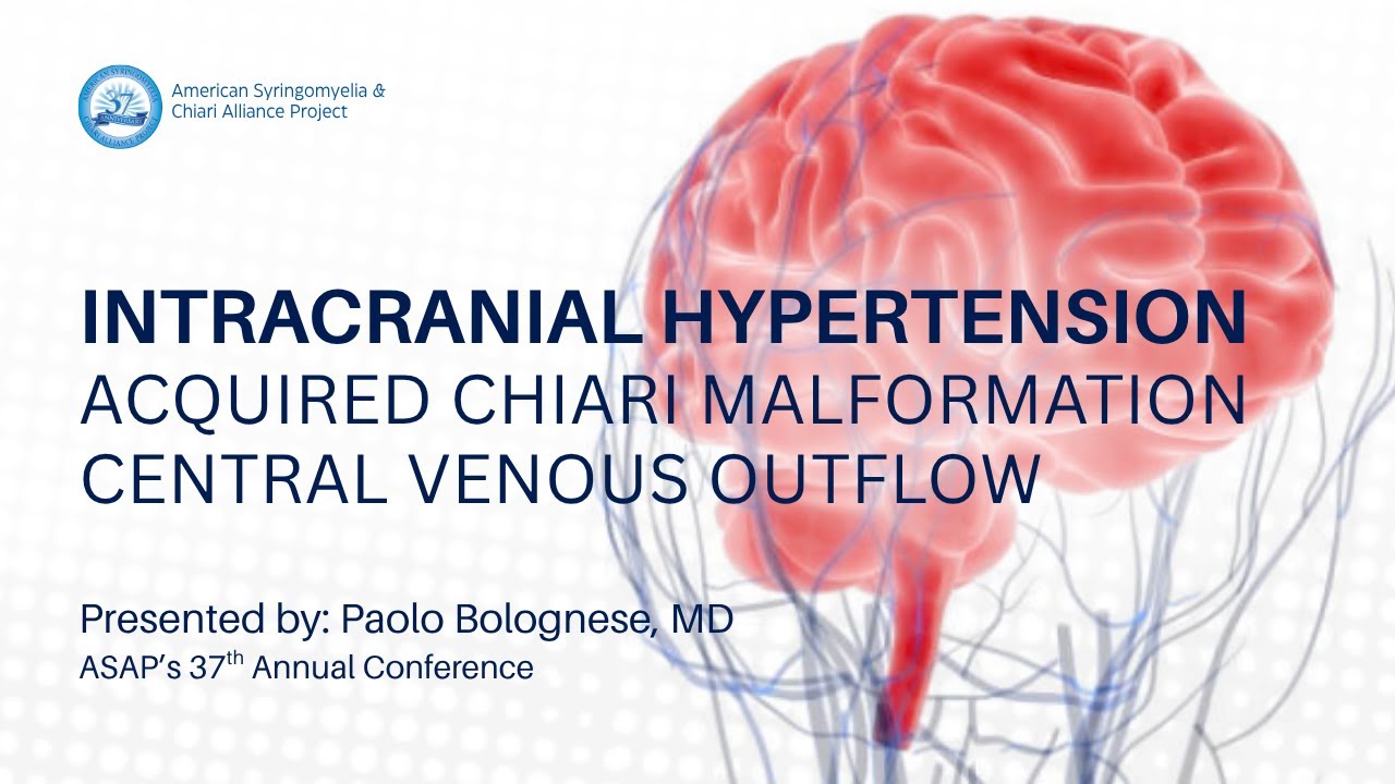 Intracranial Hypertension and Cerebral Venous Outflow - Paolo Bolognese, MD - ASAP Chiari 2025