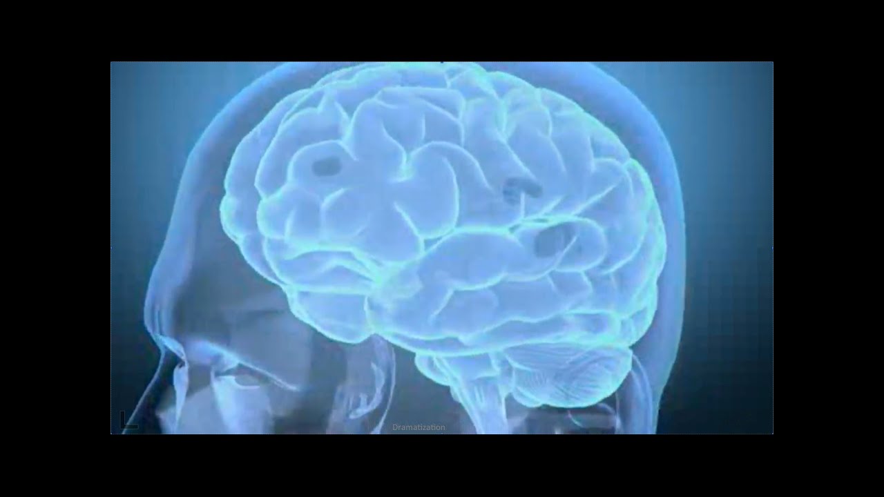 Brain Injury Information