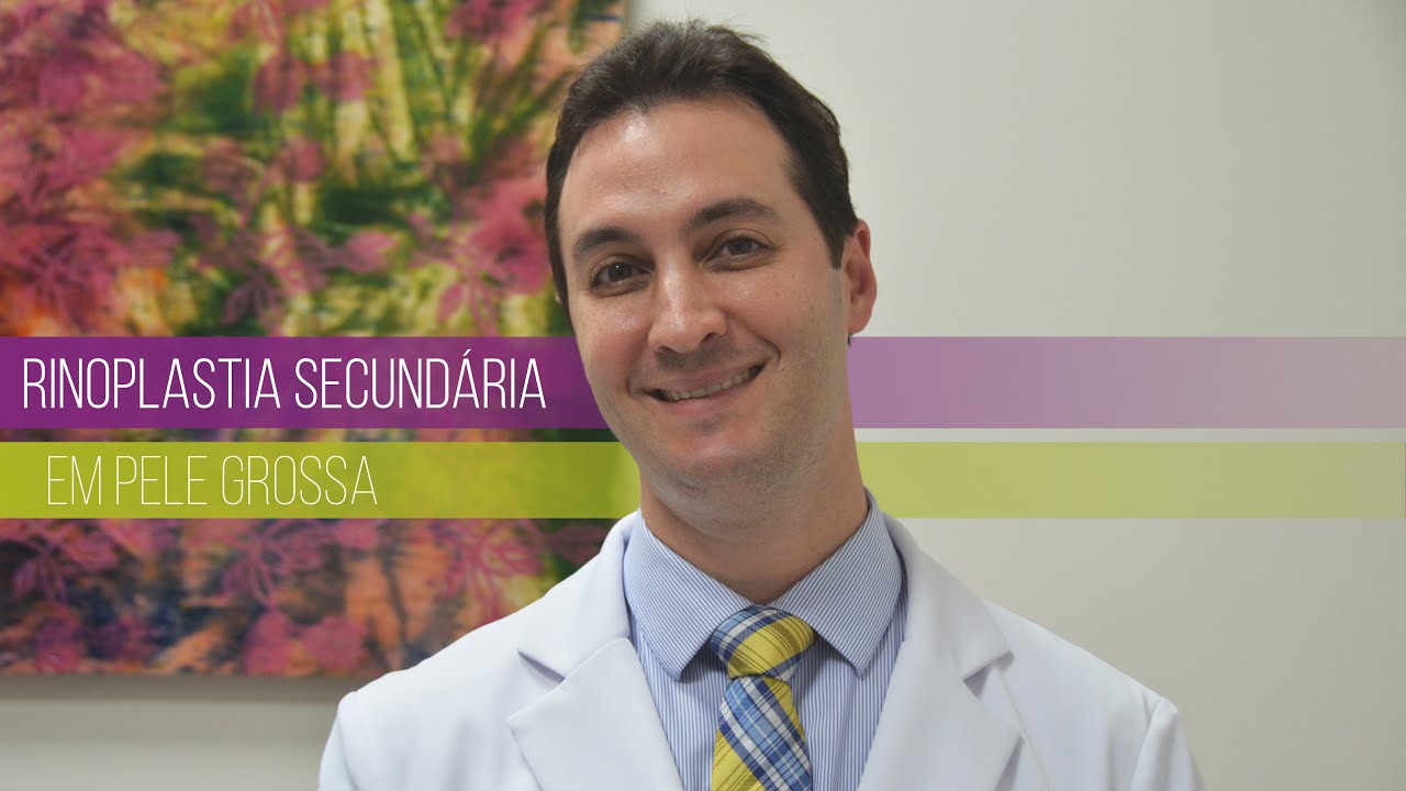 RINOPLASTIA SECUNDÁRIA em paciente com PELE GROSSA
