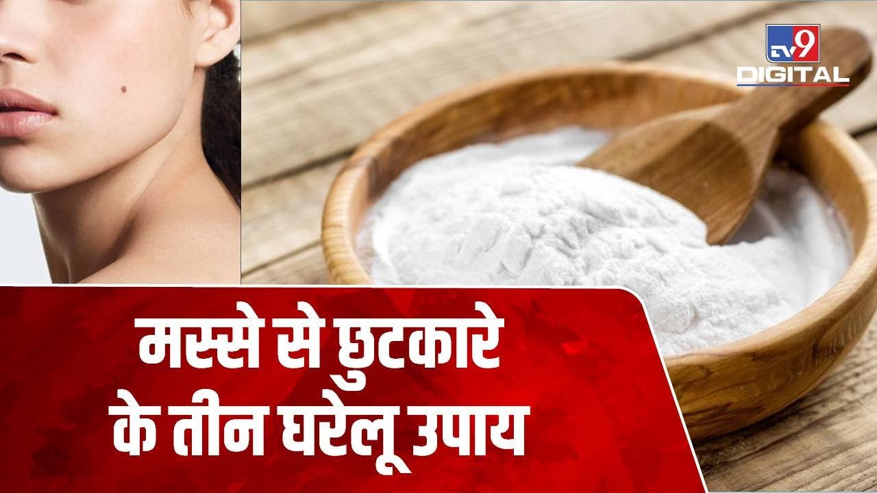 Three Homemade Remedies से पाएं मस्से (Wart) की परेशानी से छुटकारा, जानिए क्या हैं ये उपाय