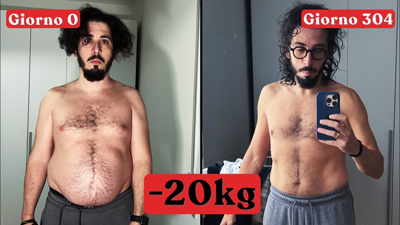 La mia Esperienza coi GLP1 da Medico e Paziente.
