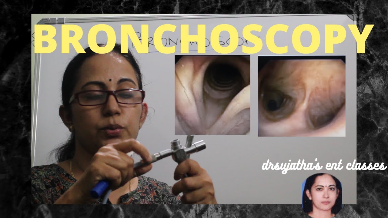 085.Бронхоскопия: Часть 1/2 #хирургическоеобразование #легкое