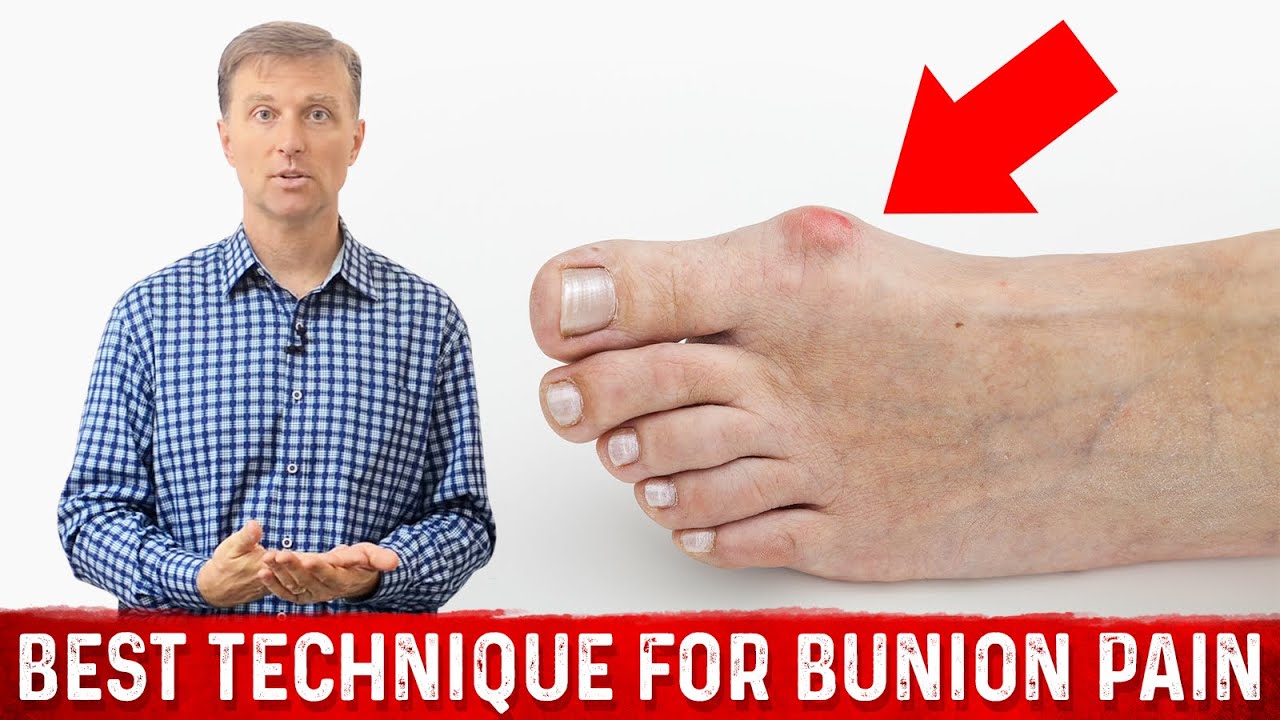 Bunion Pain Relief &ndash; The Simple & Best Technique by Dr.Berg