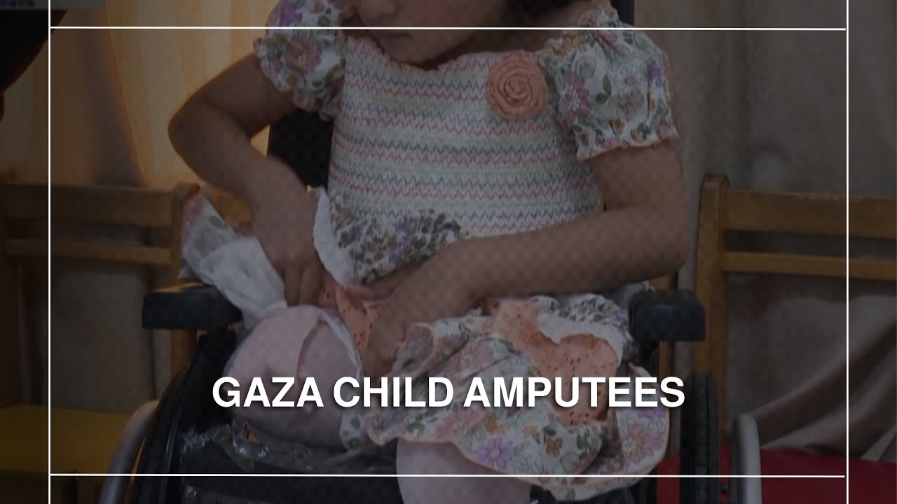 Gazan amputee children sent to Qatar for treatment and rehabilitation