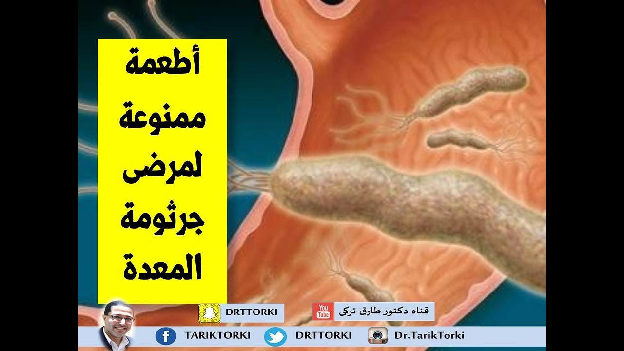الأطعمة الممنوعة على مرضى جرثومة المعدة | الأطعمة الضارة لمريض جرثومة المعدة