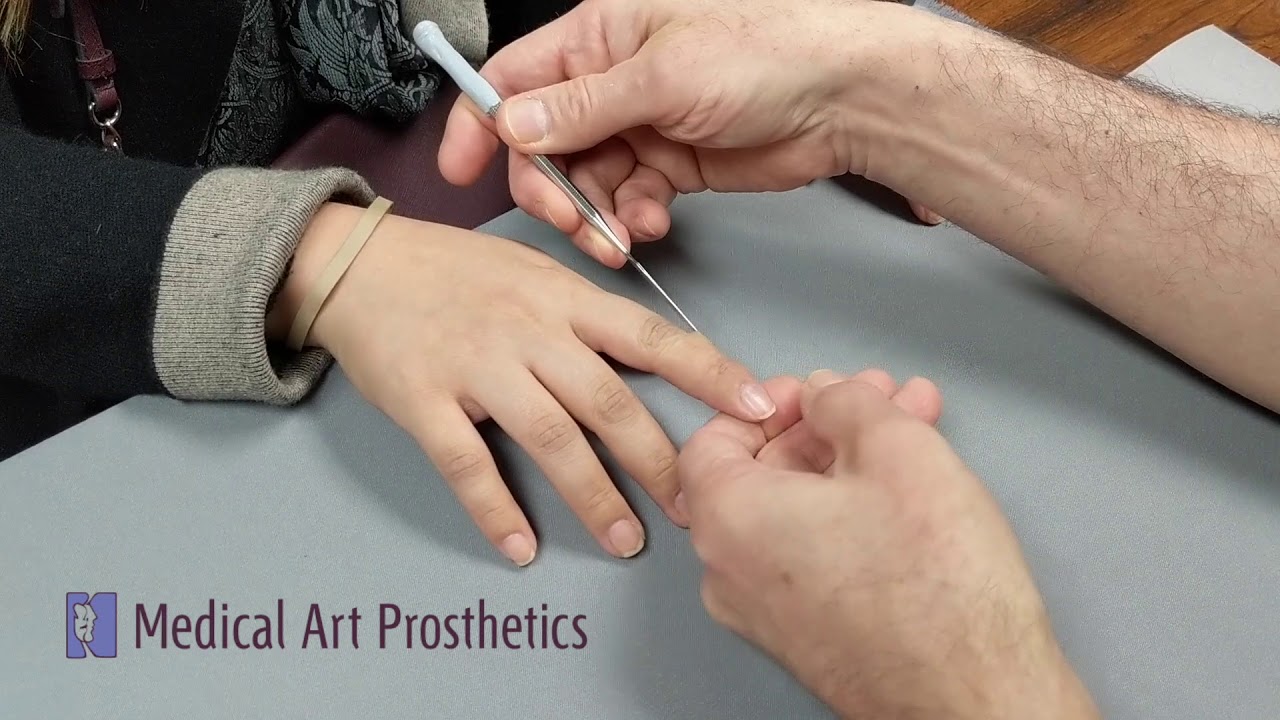 Silicone Finger Prosthesis, demonstrating ease of use