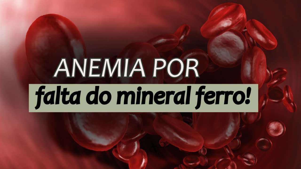ANEMIA FERROPRIVA - UMA ANEMIA COMUM MAS PREOCUPANTE