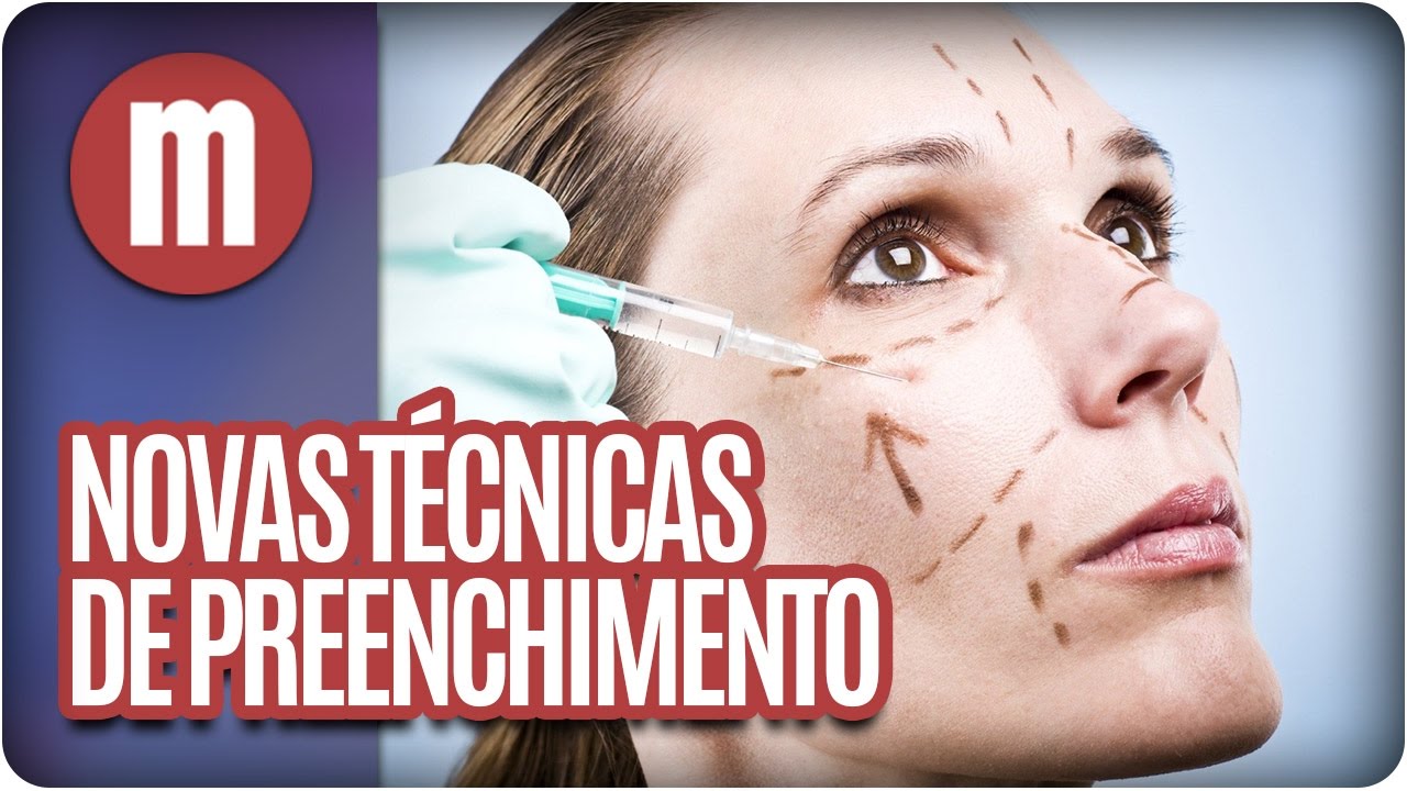 Novas técnicas de preenchimento - Mulheres (09/11/16)