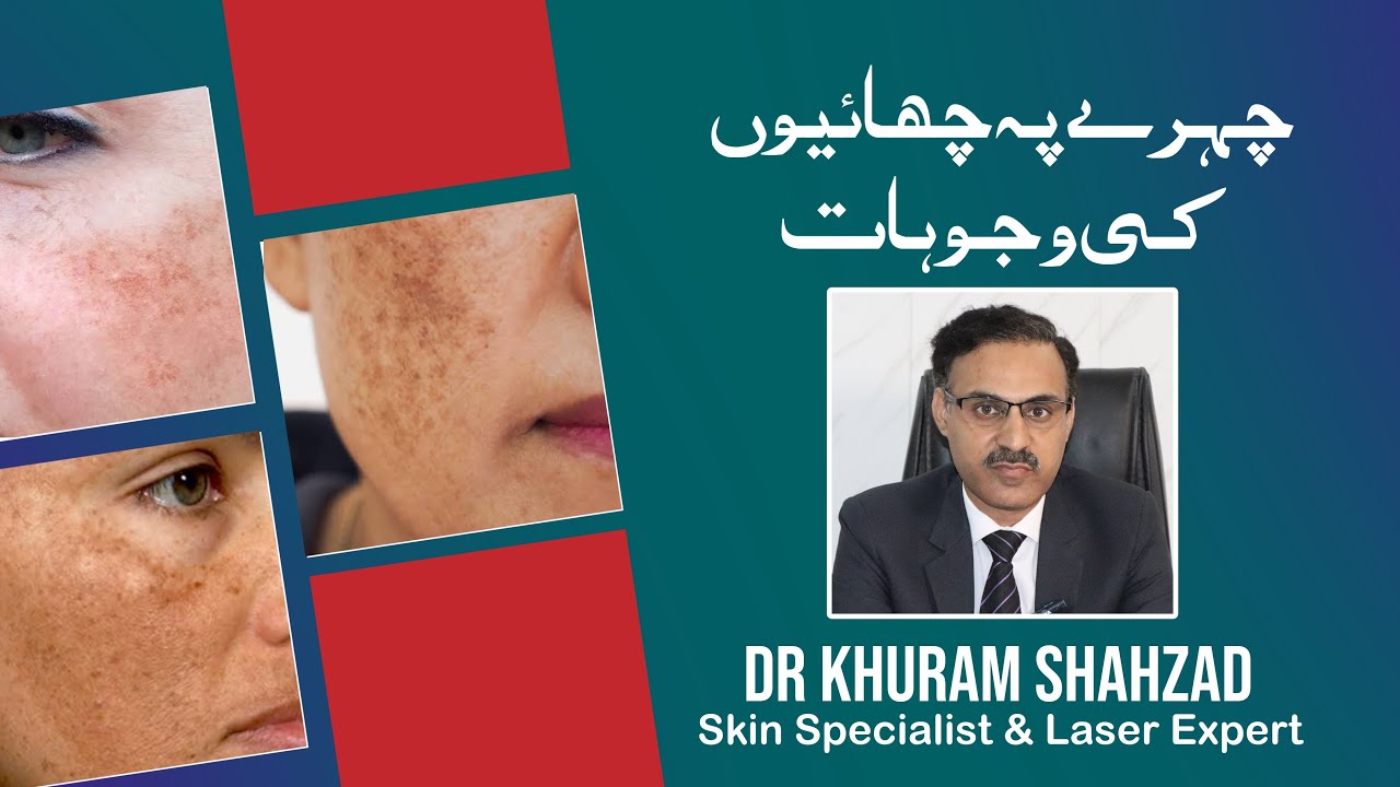Causes of dark spots on the face || Dr Khuram Shahzad || Skin Specialist & Laser Expert