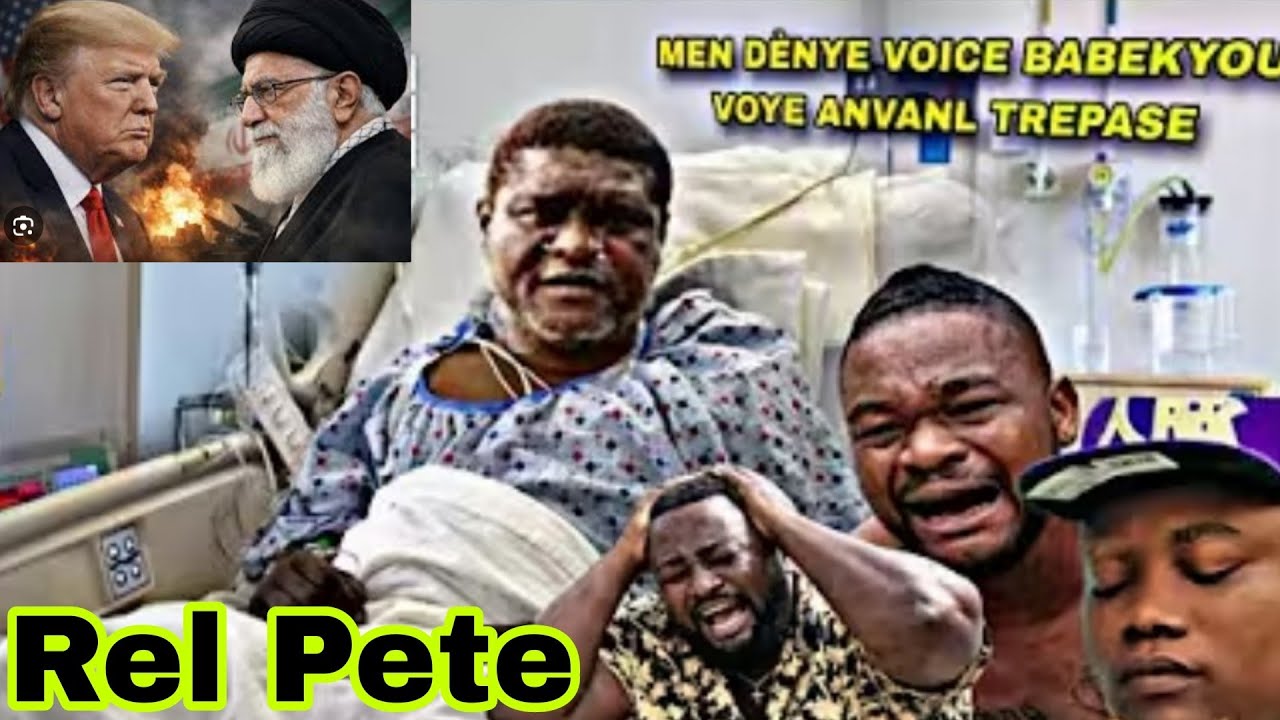 Babekyou pagen Chans Lapolis Kraze Kotel Te Kache a Chef gang lan blese Grav Yon lot kou anko.