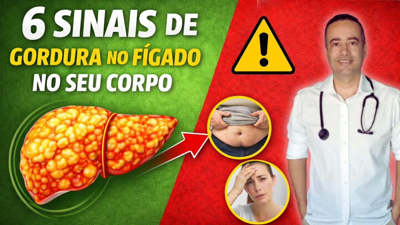 6 Sinais de Gordura no Fígado que Aparecem no Seu Corpo
