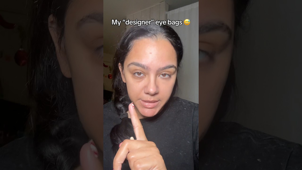 Мои дизайнерские мешки под глазами 😅 