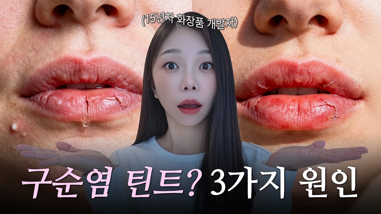 15년차 개발자가 뜯어본💄'구순염 틴트'의 원인 분석 | 적색 202호 범인❌ 진짜 문제는 따로 있다.