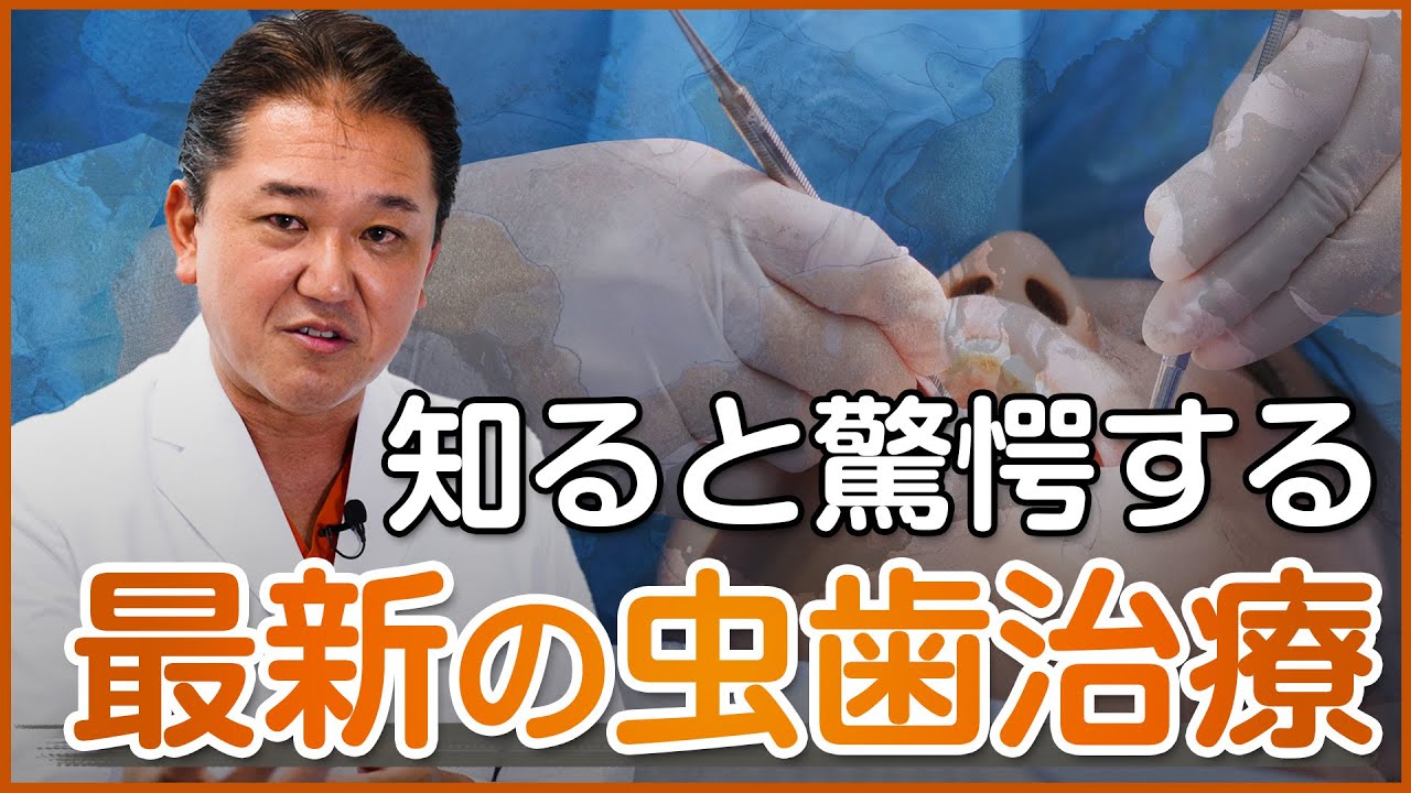 知ると驚愕する最新の虫歯治療〜前半〜