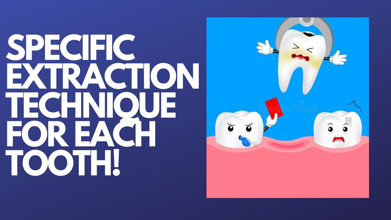 Specific Techniques Used For Extraction (Exodontia) of Each Tooth -Oral Surgery
