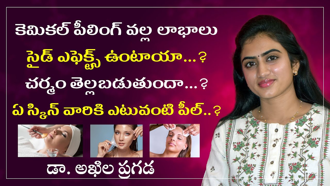 Chemical Peeling Advantages & Side Effects in Telugu | Dr. Akhila | Telugu Beauty Tips | Sunrise tv