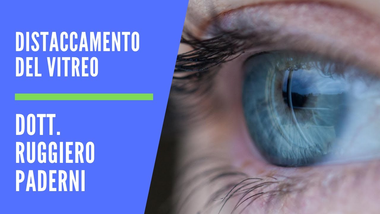 MOSCHE VOLANTI negli occhi e DISTACCO del VITREO: cosa fare??? Dott.  Ruggiero Paderni.