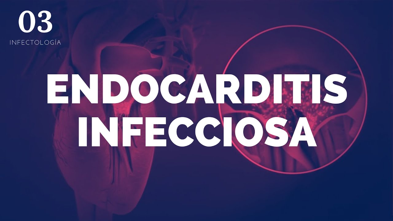 ENDOCARDITIS INFECCIOSA - ENARM