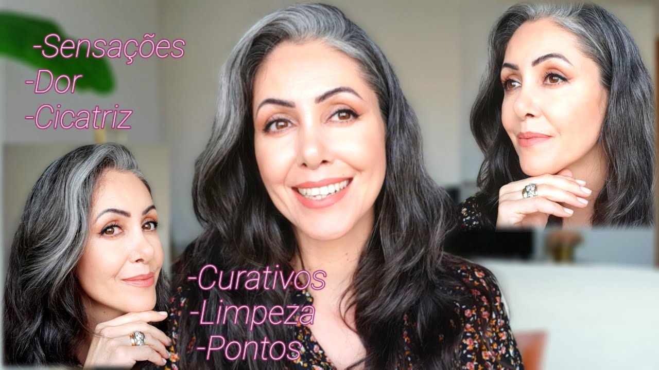 6 MESES de RINOPLASTIA - Como foi? Arrependida?