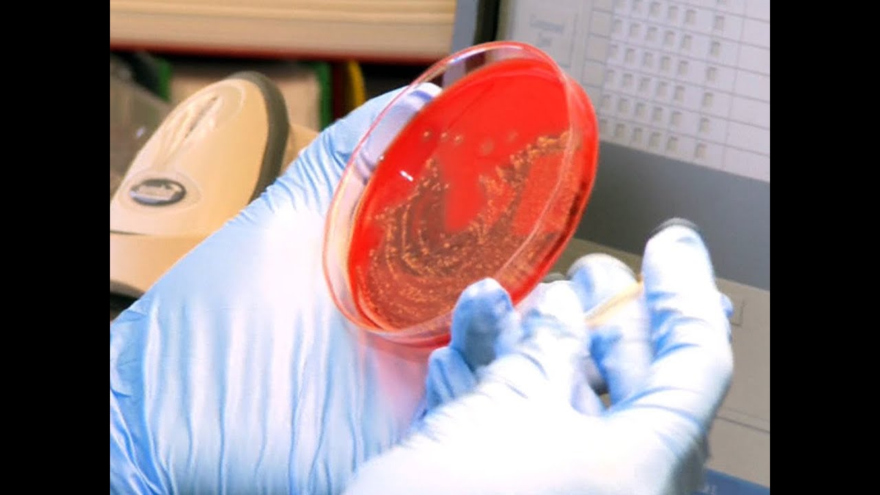Rare bacteria strain may have killed young researcher