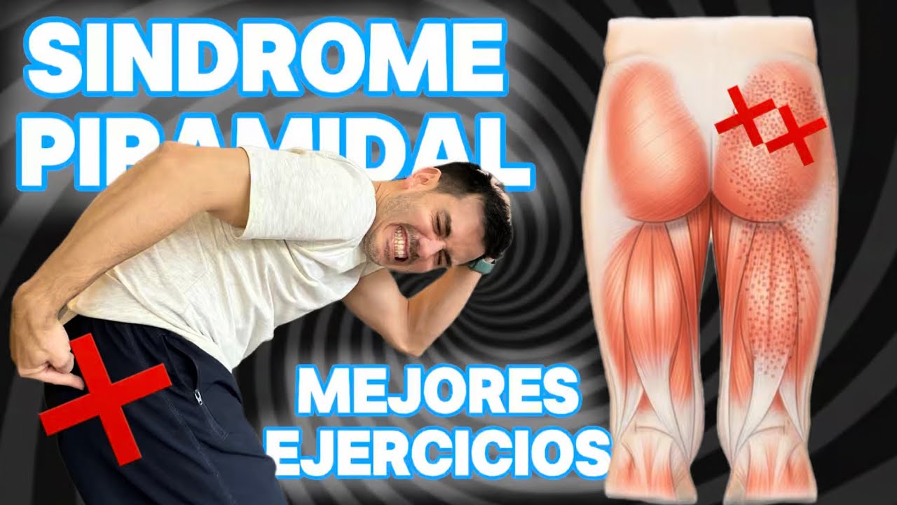 Síndrome del Piramidal: Ejercicios y Estiramientos para el Dolor Glúteo y Falsa Ciática