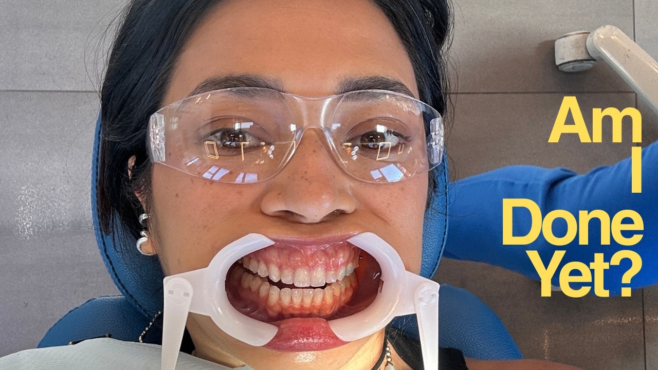 My Invisalign Journey (& my daily vlog)